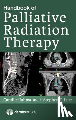 Lutz, Stephen - Handbook of Palliative Radiation Therapy