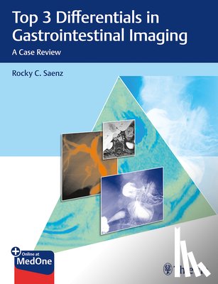 Saenz, Rocky C. - Top 3 Differentials in Gastrointestinal Imaging