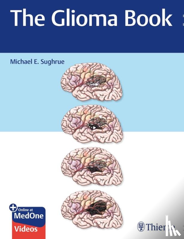 Sughrue, Michael E. - The Glioma Book