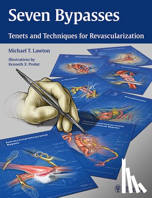 Lawton, Michael T. - Seven Bypasses