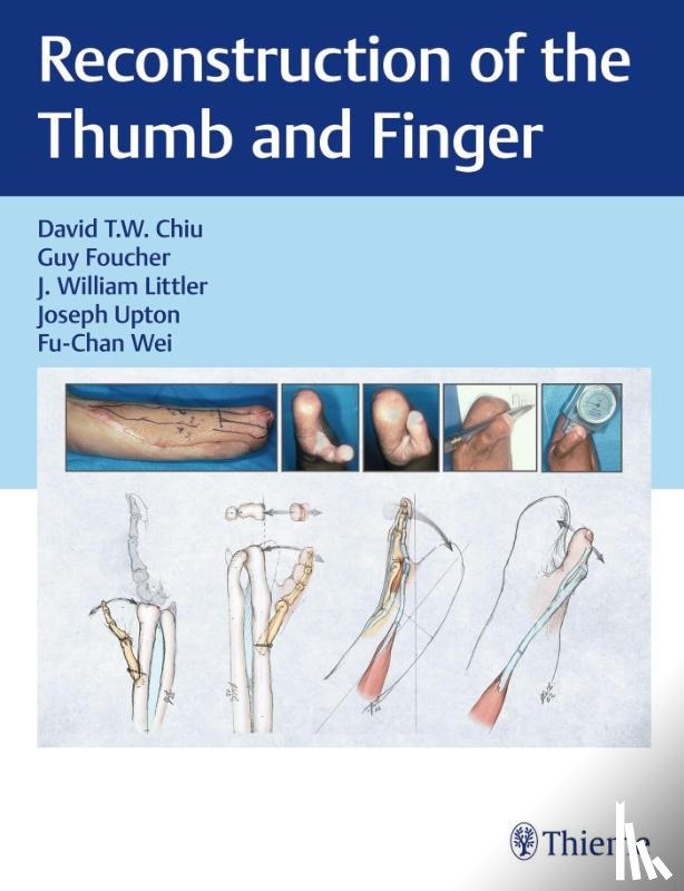  - Reconstruction of the Thumb and Finger