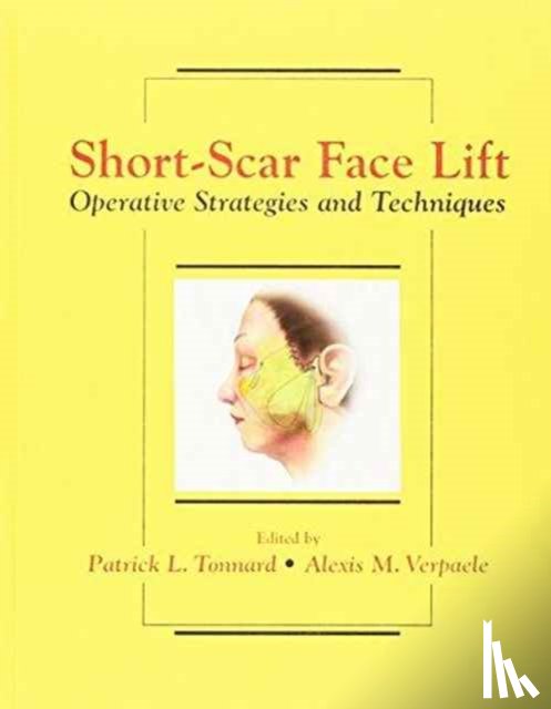 Tonnard, Patrick, Verpaele, Alexis - Short-Scar Face Lift