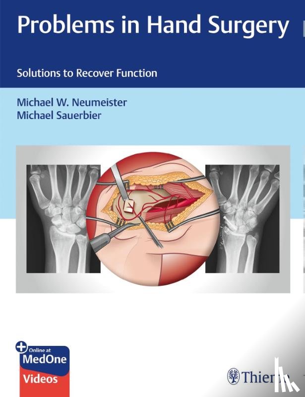  - Problems in Hand Surgery