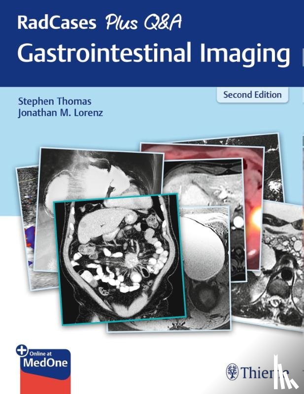 Thomas, Stephen, Lorenz, Jonathan M. - RadCases Plus Q&a Gastrointestinal Imaging