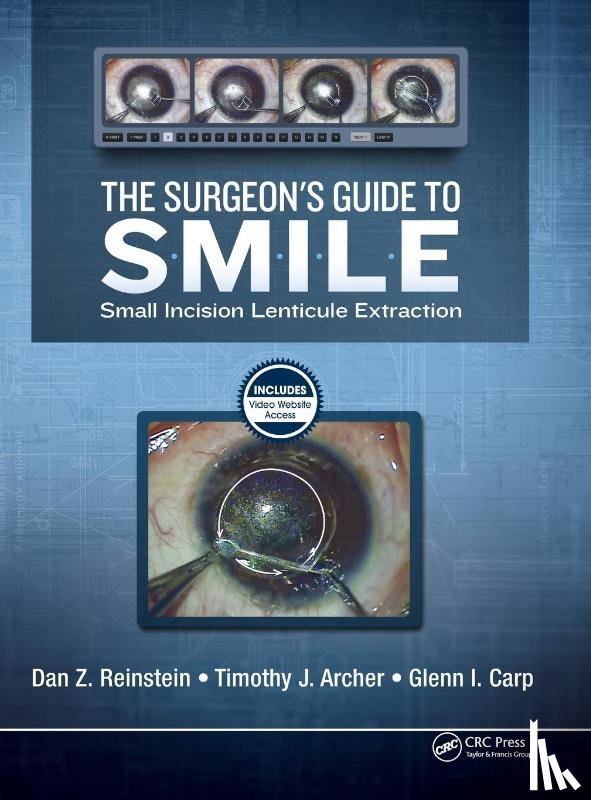 Reinstein, Dan, Archer, Timothy, Carp, Glenn - The Surgeon’s Guide to SMILE