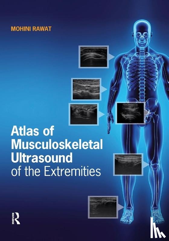 Rawat, Mohini - Atlas of Musculoskeletal Ultrasound of the Extremities