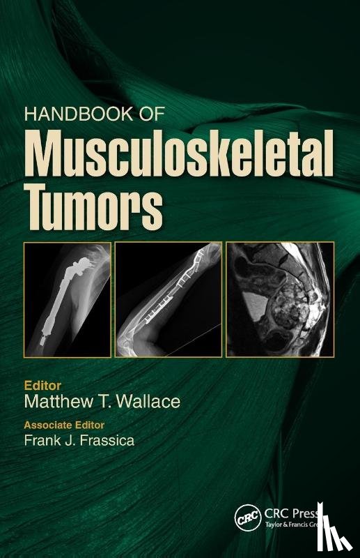 Wallace, Matthew, Frassica, Frank - Handbook of Musculoskeletal Tumors