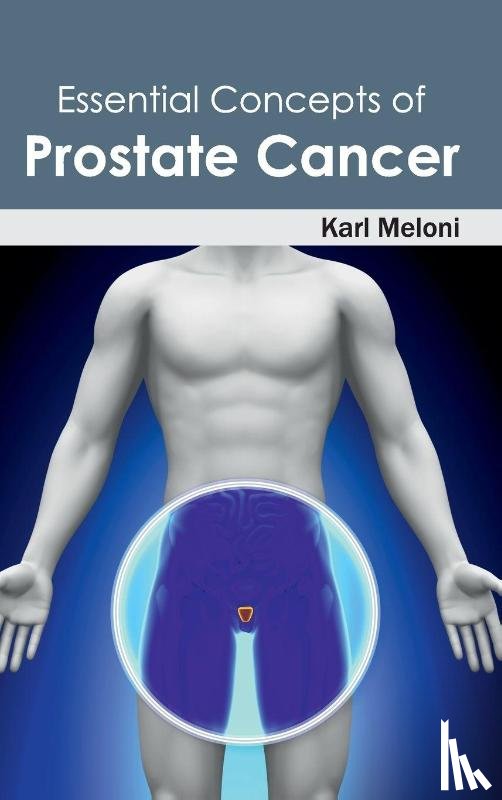  - Essential Concepts of Prostate Cancer