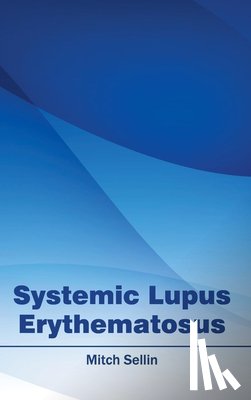  - Systemic Lupus Erythematosus
