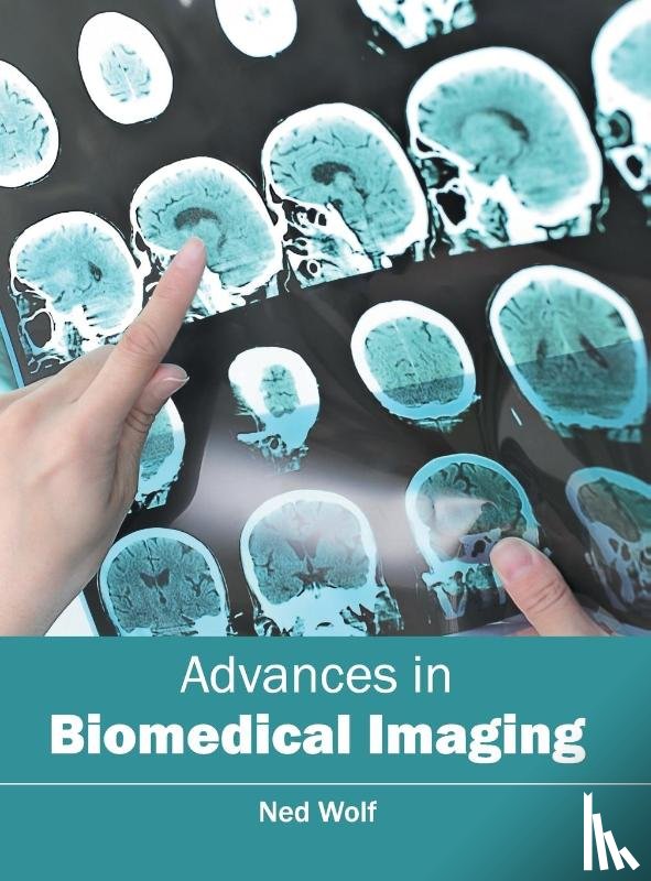  - Advances in Biomedical Imaging