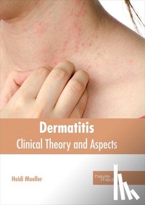  - Dermatitis: Clinical Theory and Aspects