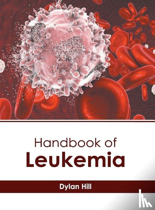  - Handbook of Leukemia