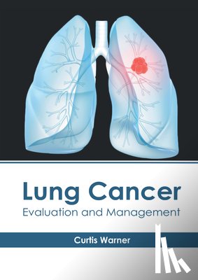  - Lung Cancer: Evaluation and Management