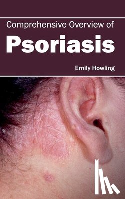 - Comprehensive Overview of Psoriasis