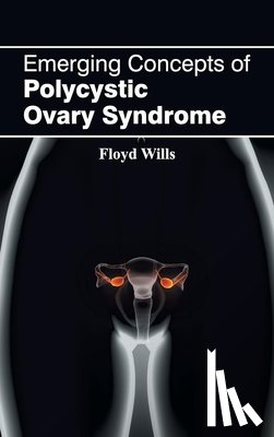  - Emerging Concepts of Polycystic Ovary Syndrome