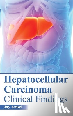  - Hepatocellular Carcinoma: Clinical Findings