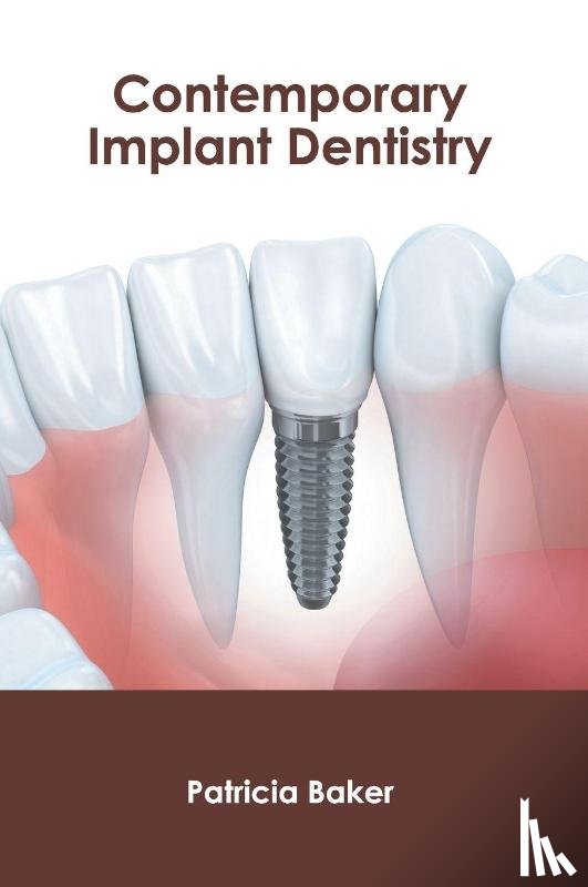  - Contemporary Implant Dentistry