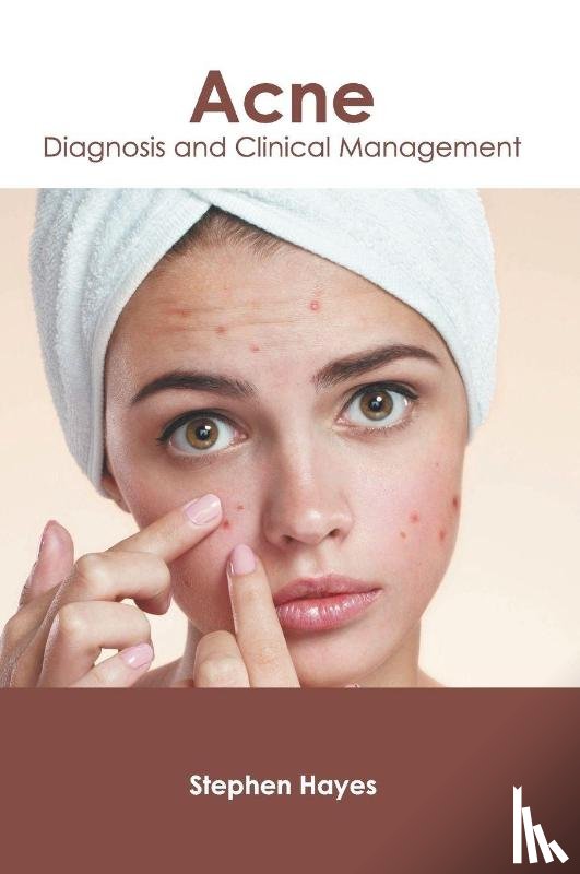  - Acne: Diagnosis and Clinical Management