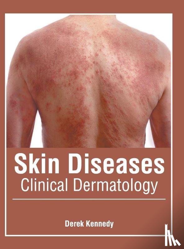  - Skin Diseases: Clinical Dermatology