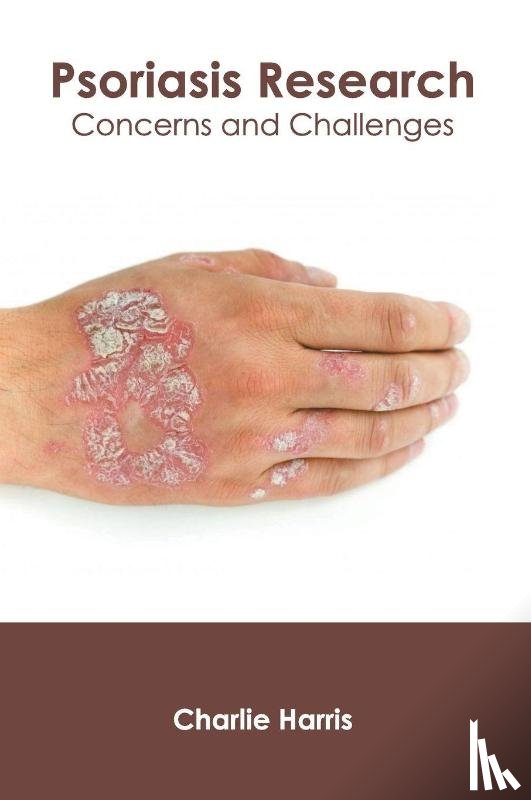  - Psoriasis Research: Concerns and Challenges
