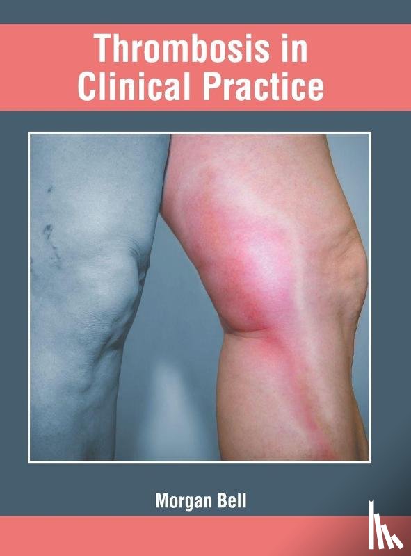  - Thrombosis in Clinical Practice