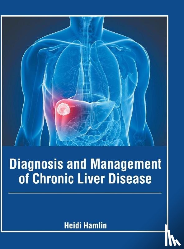  - Diagnosis and Management of Chronic Liver Disease