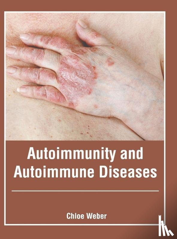  - Autoimmunity and Autoimmune Diseases