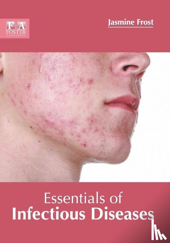  - Essentials of Infectious Diseases