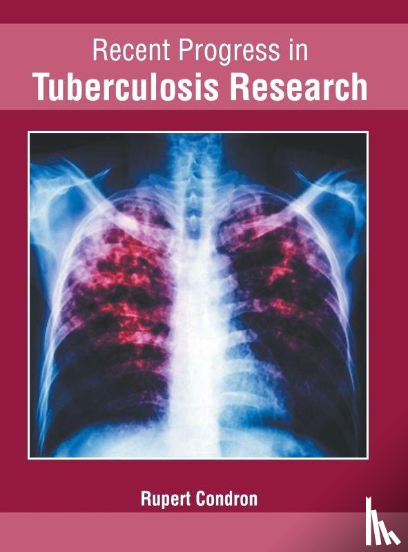  - Recent Progress in Tuberculosis Research