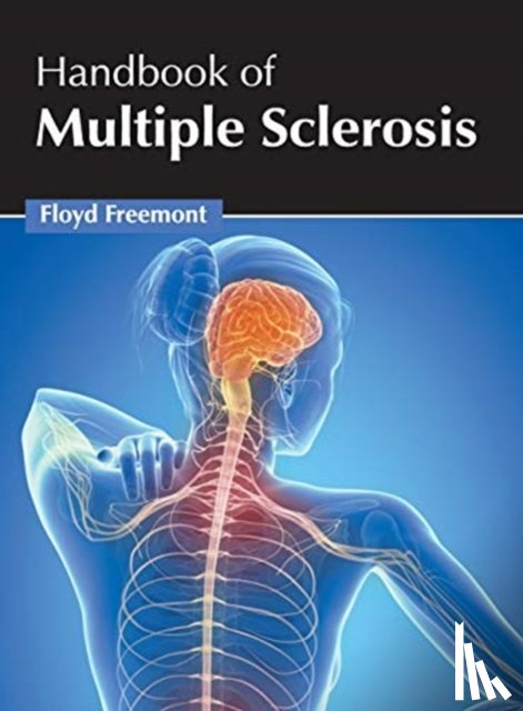  - Handbook of Multiple Sclerosis