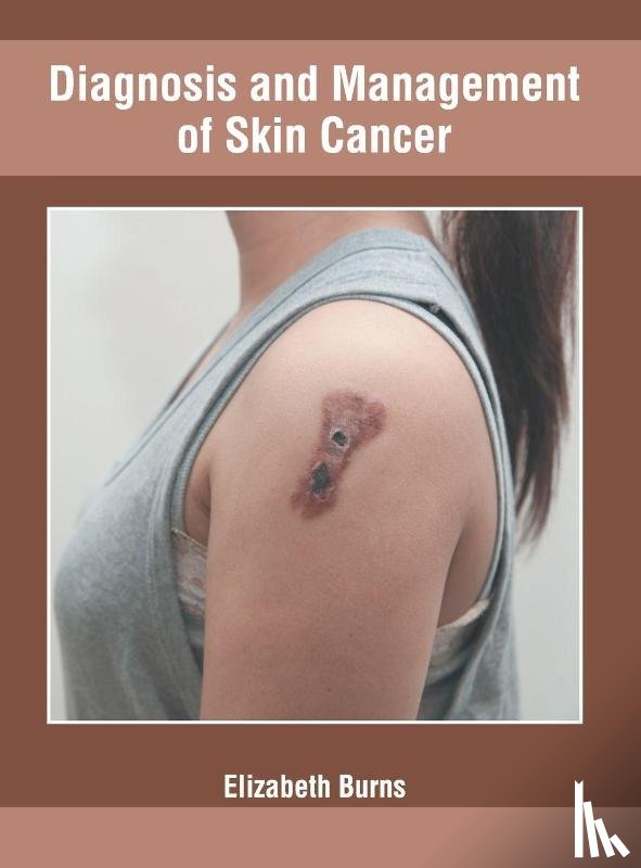  - Diagnosis and Management of Skin Cancer