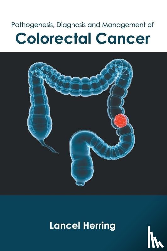  - Pathogenesis, Diagnosis and Management of Colorectal Cancer