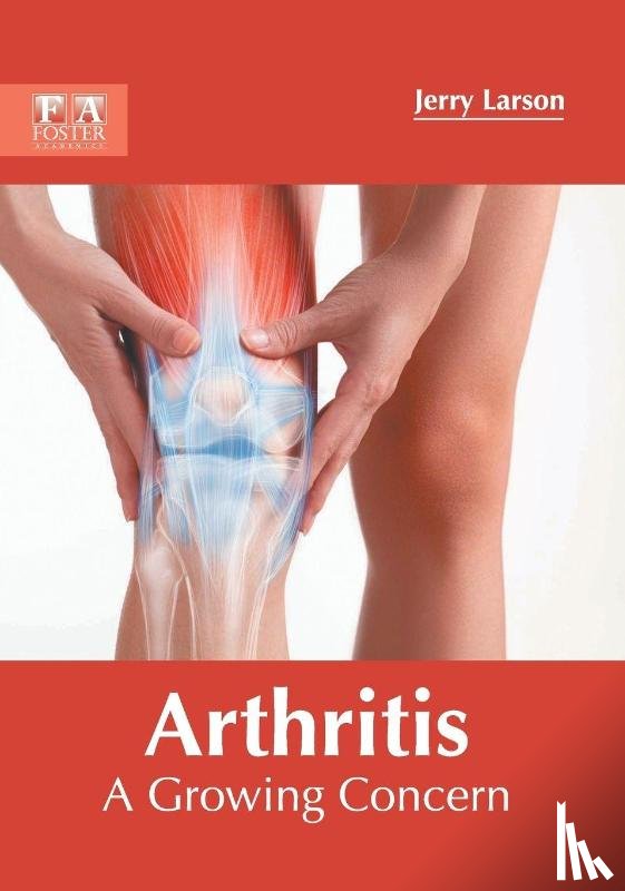  - Arthritis: A Growing Concern