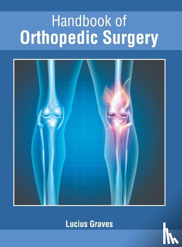  - Handbook of Orthopedic Surgery