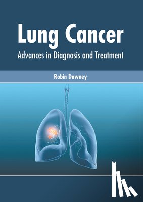  - Lung Cancer: Advances in Diagnosis and Treatment