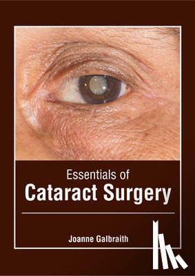  - Essentials of Cataract Surgery