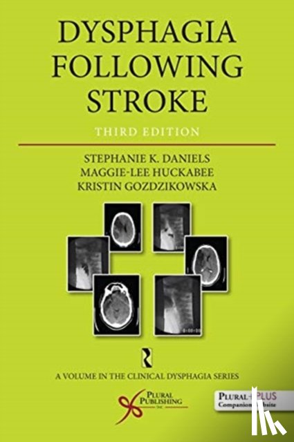 Daniels, Stephanie K., Huckabee, Maggie Lee, Gozdzikowska, Kristin - Dysphagia Following Stroke