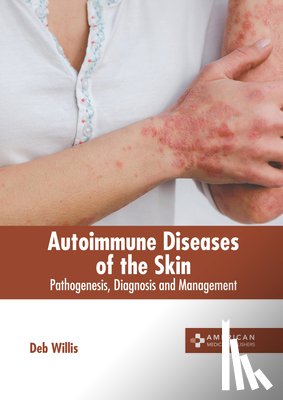 Willis, Deb - Autoimmune Diseases of the Skin: Pathogenesis, Diagnosis and Management