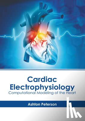 Peterson, Ashton - Cardiac Electrophysiology: Computational Modeling of the Heart