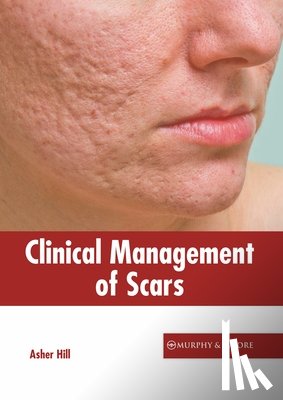  - Clinical Management of Scars