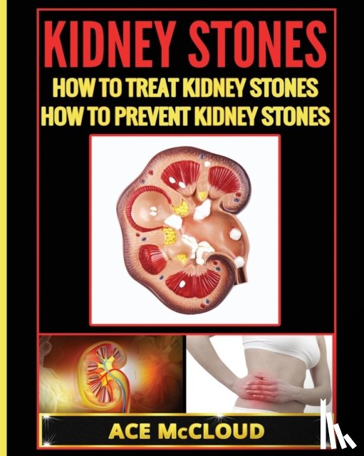 McCloud, Ace - Kidney Stones