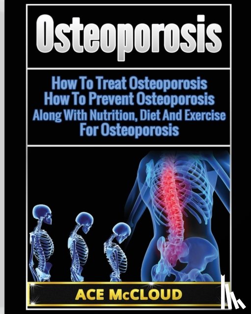 McCloud, Ace - Osteoporosis