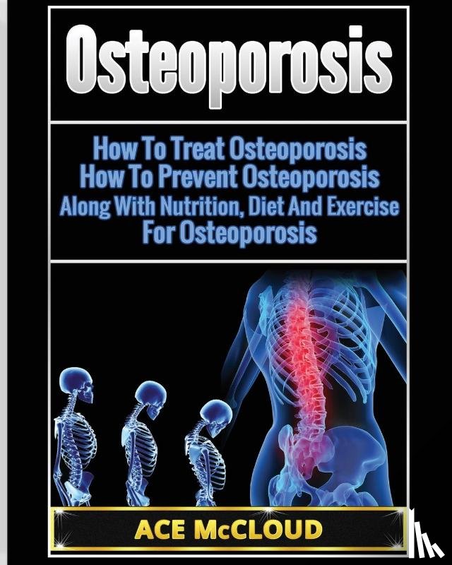 McCloud, Ace - Osteoporosis