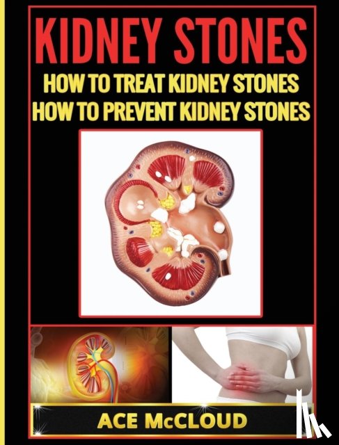 McCloud, Ace - Kidney Stones
