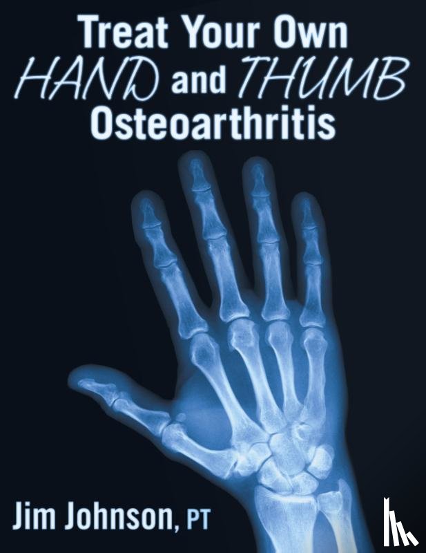 Johnson, Jim - Treat Your Own Hand and Thumb Osteoarthritis