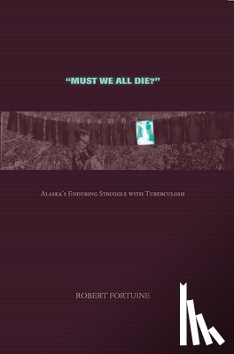 Fortuine, Robert - Must We All Die?: Alaska's Enduring Struggle with Tuberculosis