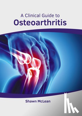  - A Clinical Guide to Osteoarthritis