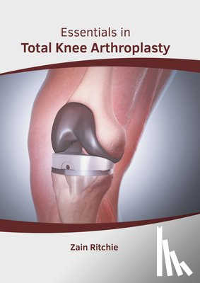  - Essentials in Total Knee Arthroplasty