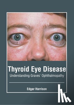 Harrison, Edgar - Thyroid Eye Disease: Understanding Graves' Ophthalmopathy