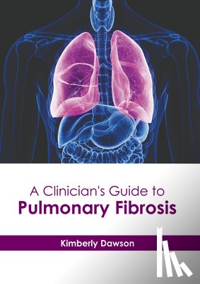 Dawson, Kimberly - A Clinician's Guide to Pulmonary Fibrosis